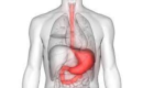 Gastric Problems